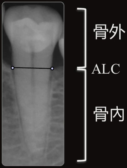 B-CRR 以 ALC 為分界