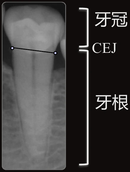 CRR 以 CEJ 為分界